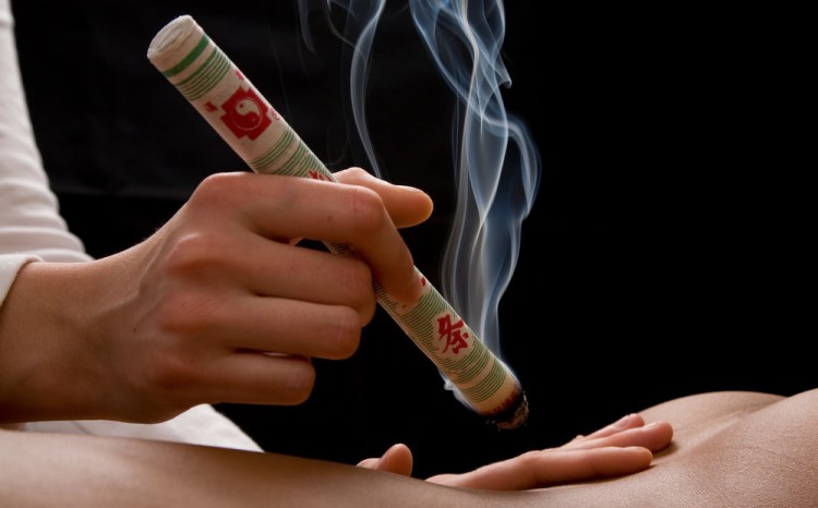baton de moxa approché du patient
